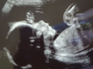 Baby Scott @ 21 weeks, 3 days!